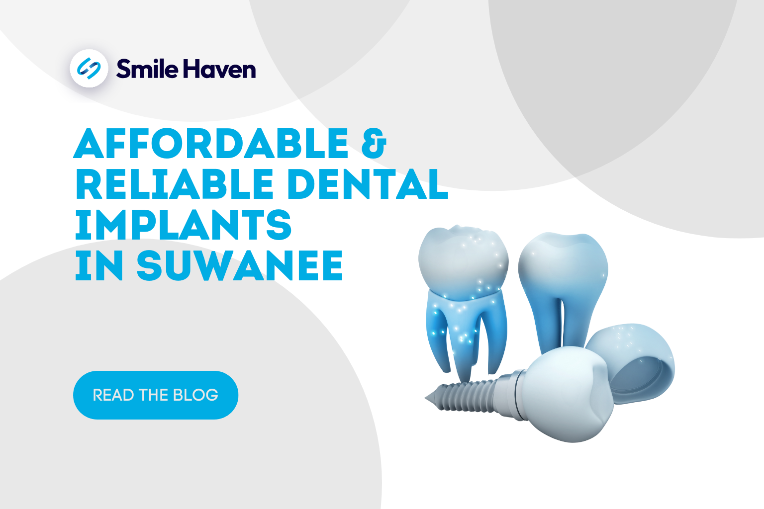 Affordable & Reliable Dental Implants in Suwanee