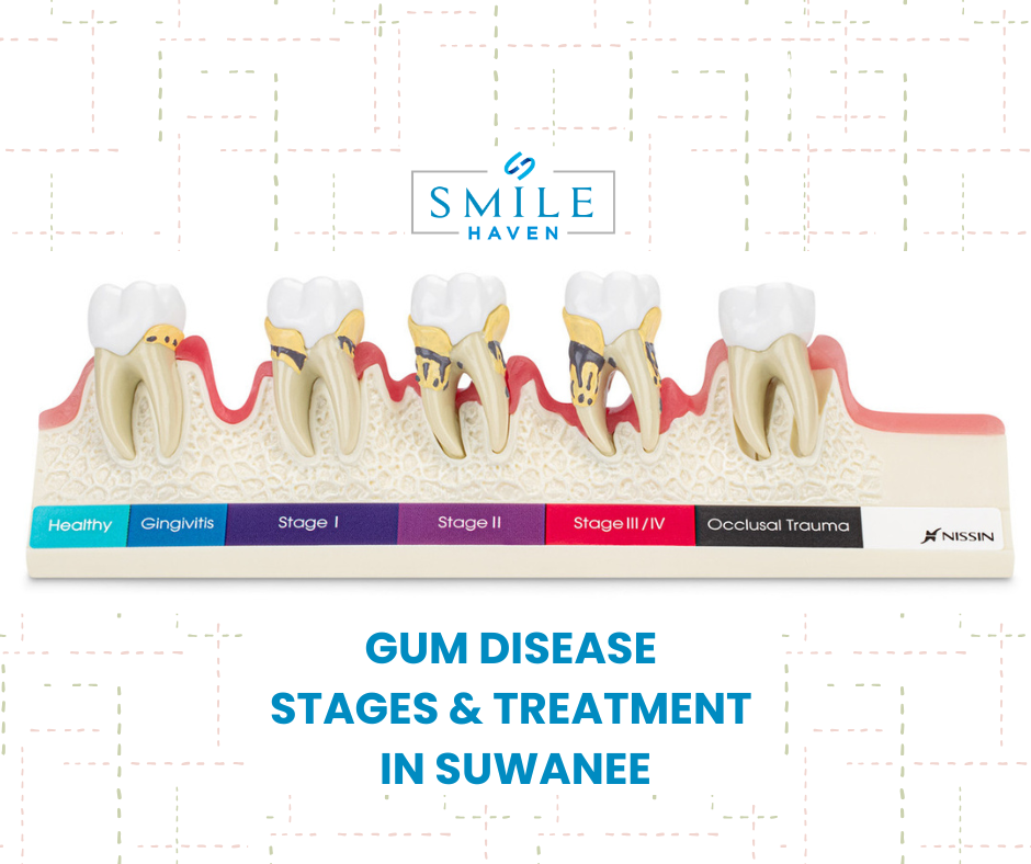 periodontal treatment bleeding gums